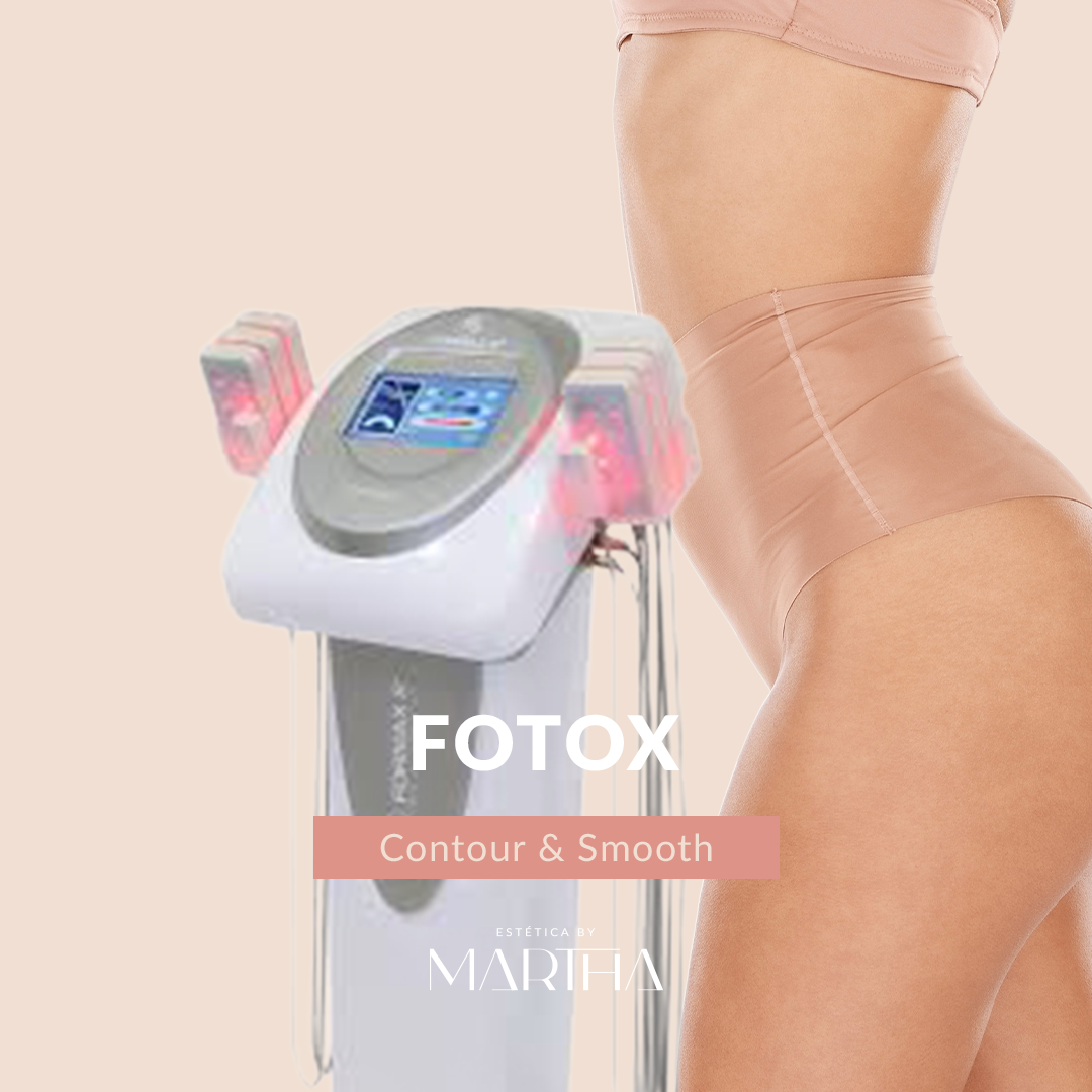 FOTOX
